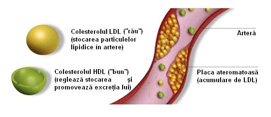 Colesterolul și trigliceridele - ALARMĂ!